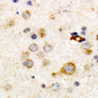 Anti-Clusterin Antibody