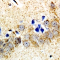 Anti-Carboxypeptidase A6 Antibody