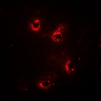 Anti-Alpha-crystallin A Antibody