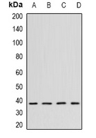 CK2 alpha Rabbit Polyclonal Antibody