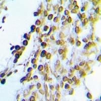 Anti-CK2 alpha Antibody