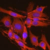 Anti-CK2 alpha Antibody