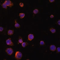 Anti-CTGF Antibody