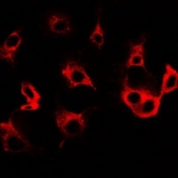 Anti-Cullin 5 Antibody