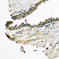 Anti-CXCL11 Antibody
