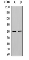 Cytochrome P450 4F12 Rabbit Polyclonal Antibody