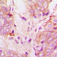 Anti-Cytochrome P450 51A1 Antibody