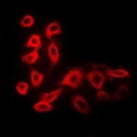 Anti-Cytochrome P450 51A1 Antibody