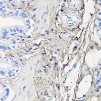 Anti-Decorin Antibody