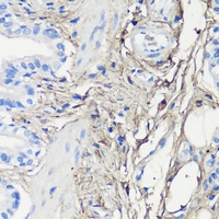 DCN antibody