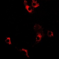 Anti-Decorin Antibody