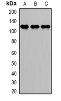 DDX58 Rabbit Polyclonal Antibody
