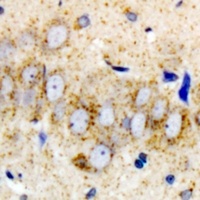 Anti-DHODH Antibody