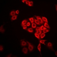 Anti-DHRS9 Antibody