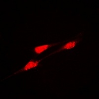 Anti-DLGAP5 Antibody