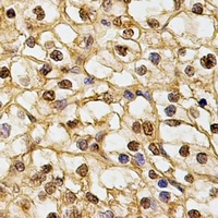 DNAJB6 antibody