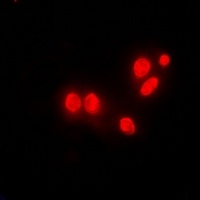 DNAJB6 antibody