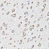 Anti-EEF1A2 Antibody
