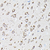 EEF1A2 antibody