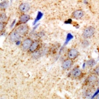 Anti-EEF1D Antibody