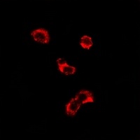 Anti-EEF1D Antibody