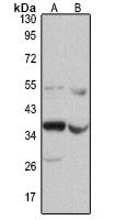 Ephrin B2 Rabbit Polyclonal Antibody
