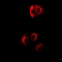 Anti-EIF4B Antibody
