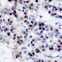 Anti-EZH2 Antibody