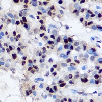 EZH2 antibody