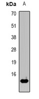H-FABP Rabbit Polyclonal Antibody
