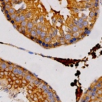 H-FABP Rabbit Polyclonal Antibody