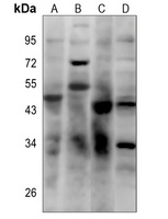 CD16b Rabbit Polyclonal Antibody