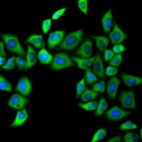 Anti-FMO3 Antibody