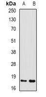 GADD45 alpha Rabbit Polyclonal Antibody