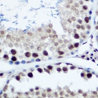 Anti-GADD45 alpha Antibody