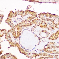 Anti-GFRA1 Antibody