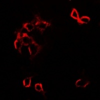 Anti-GFRA1 Antibody