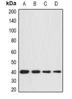 GNA11 Rabbit Polyclonal Antibody