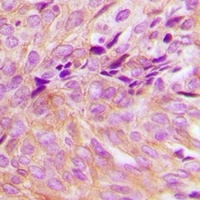 Anti-GNA13 Antibody