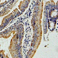 Anti-GNAI3 Antibody