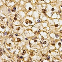 Anti-CSN1 Antibody