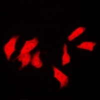 Anti-CSN1 Antibody