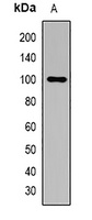 Gelsolin Rabbit Polyclonal Antibody