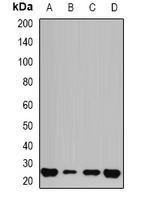 GSTP1 Antibody