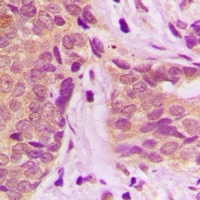 Anti-GSTP1 Antibody