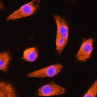 Anti-GSTP1 Antibody
