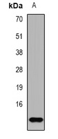 TF2A2 Rabbit Polyclonal Antibody