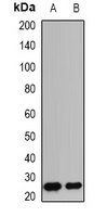 Granzyme B Rabbit Polyclonal Antibody