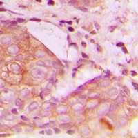 TIM3 Antibody