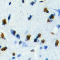 Anti-HDGF Antibody
